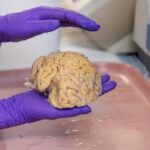 cerebro-‘superancianos