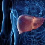 cirrosis