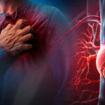 infarto-o-paro-cardiaco