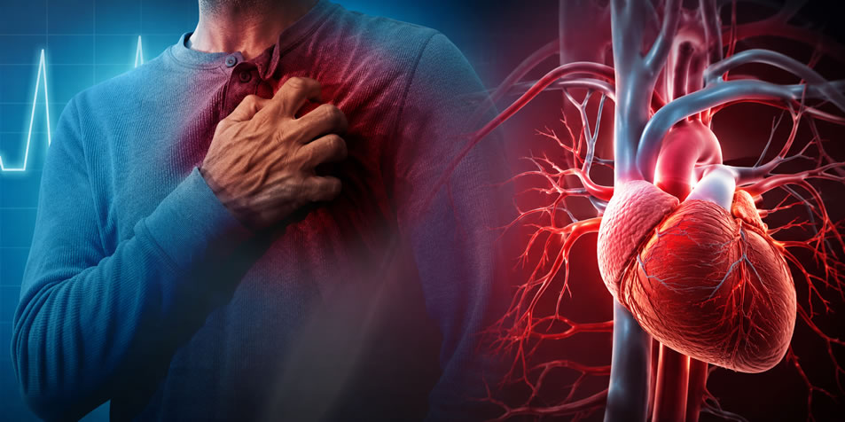 infarto-o-paro-cardiaco
